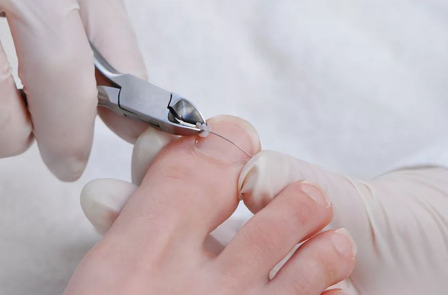 pediatric foot treatment